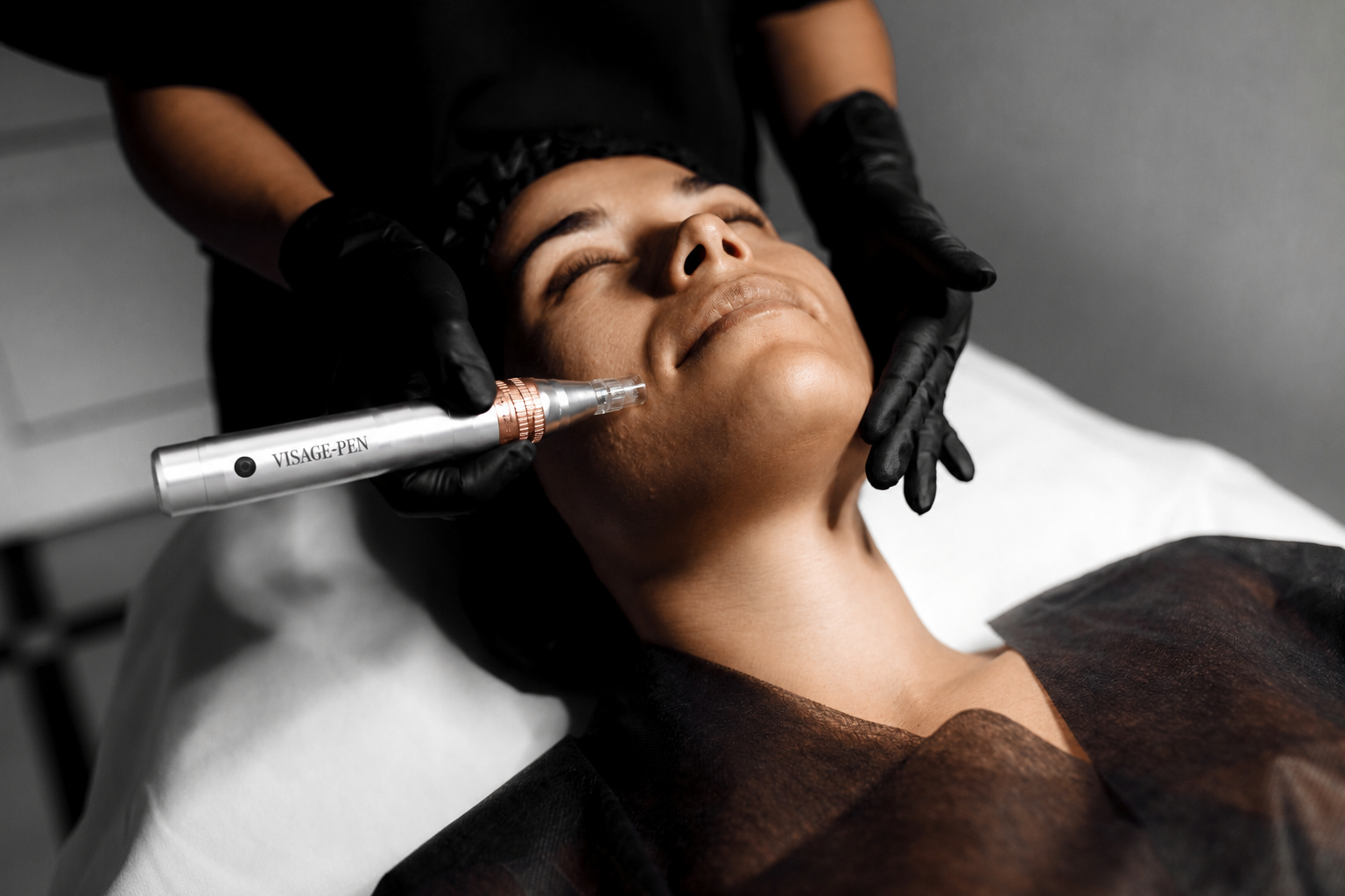Microneedling Behandlung bei Visage Cosmetic